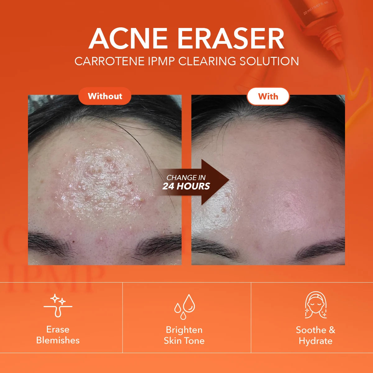 [APRILSKIN] Carrotene IPMP™ Clearing Solution