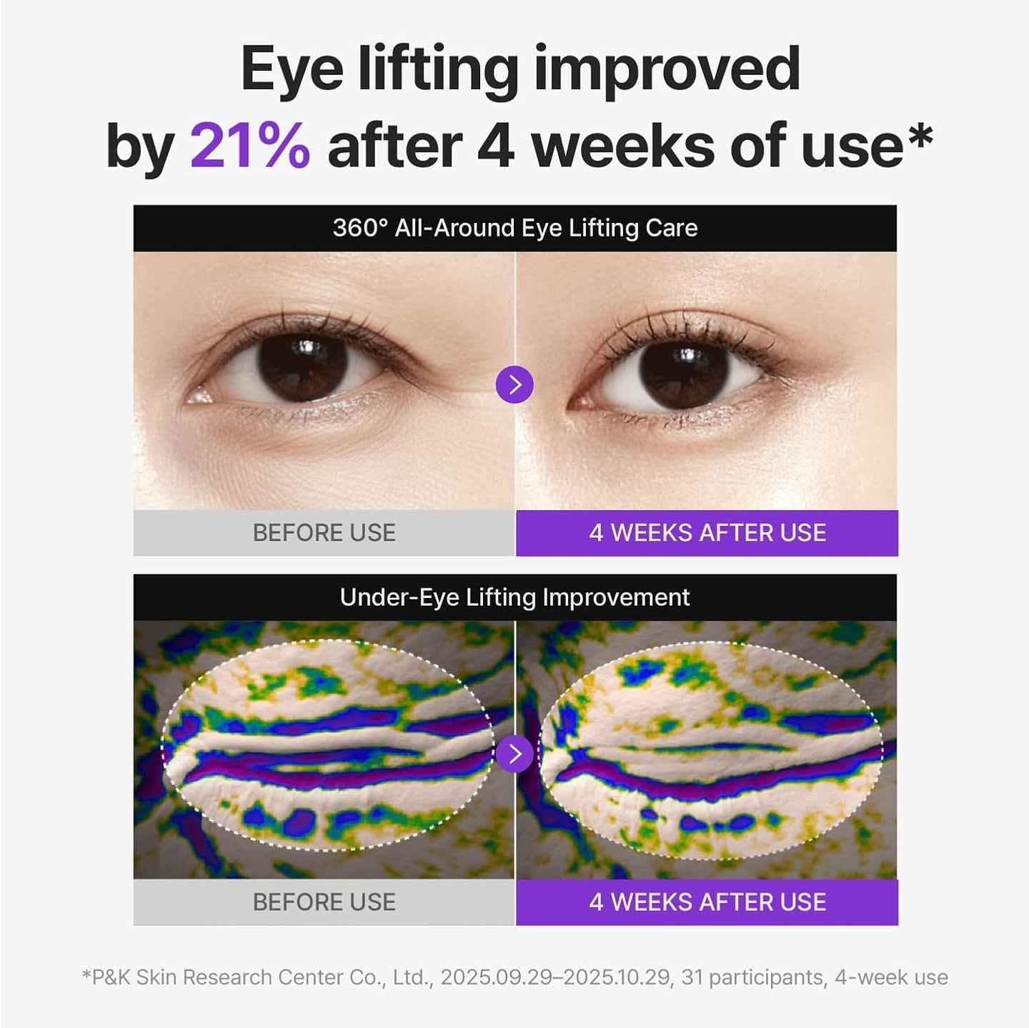 [CENTELLIAN24] 360º Shot PDRN lifting Eye cream