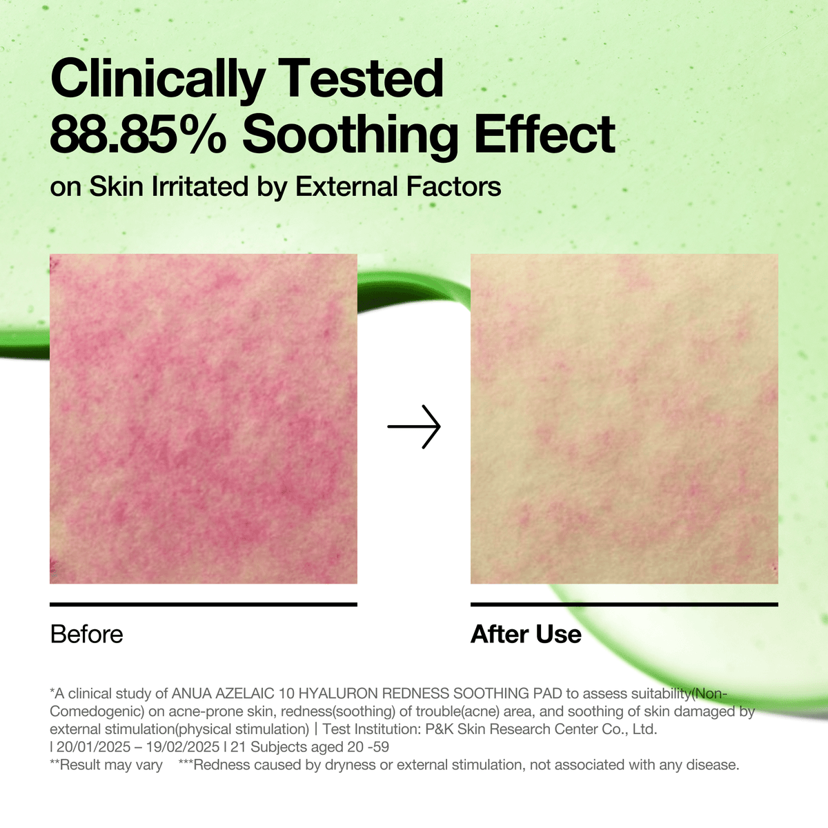 [ANUA] Azelaic 10 Hyaluron Redness Soothing Pad