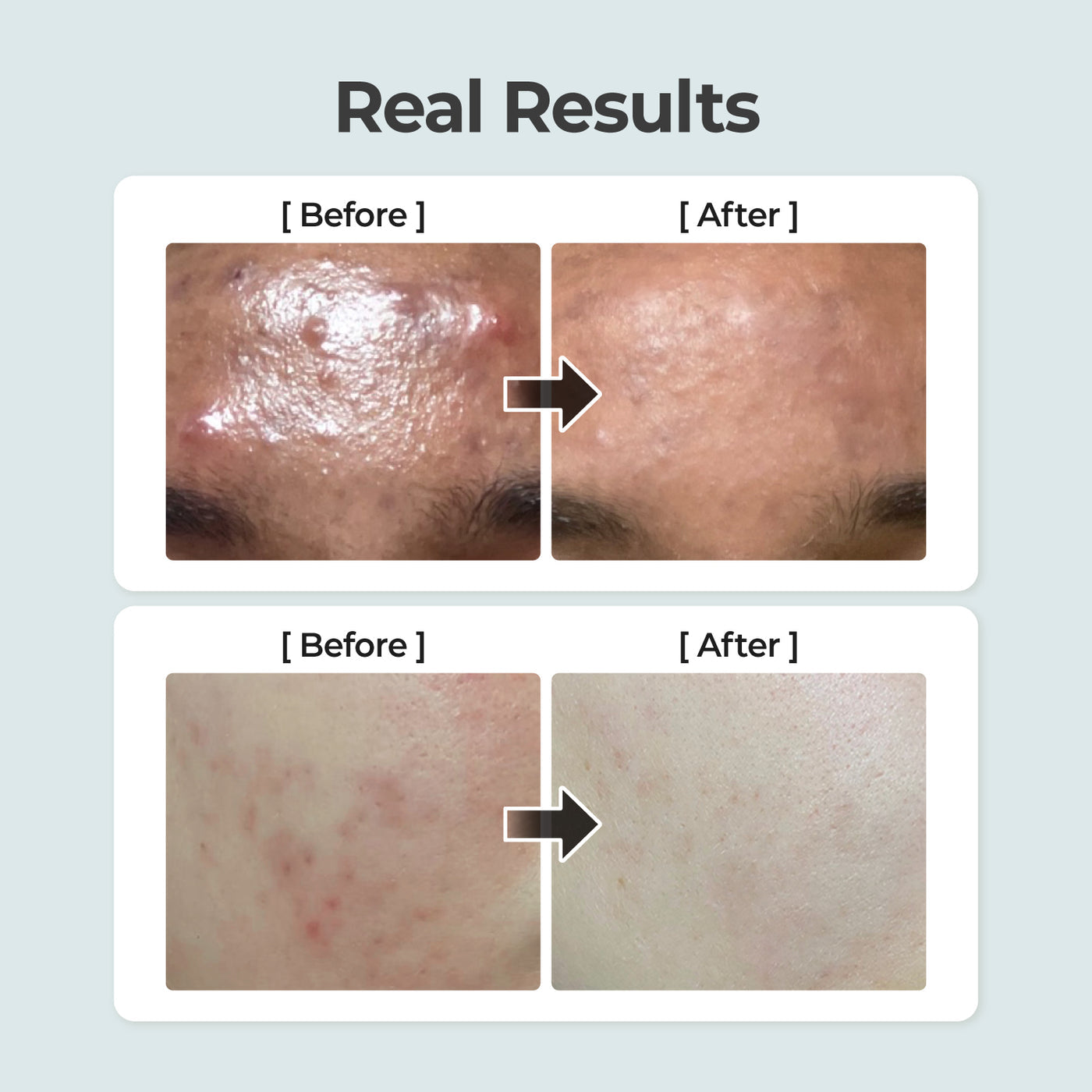 [NUMBUZIN] NO.1 Pure-Full Calming Herb Toner