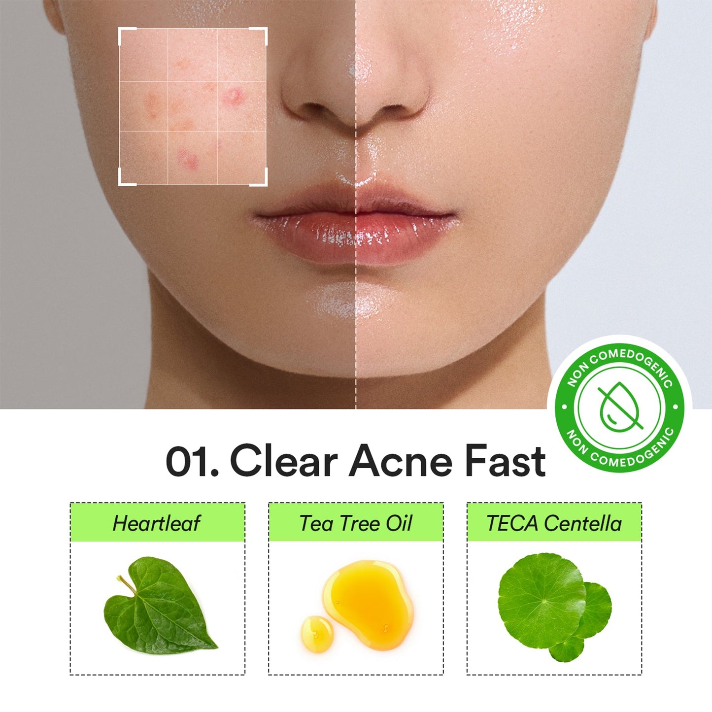 [ABIB] Hearleaf Calming Spot Patch