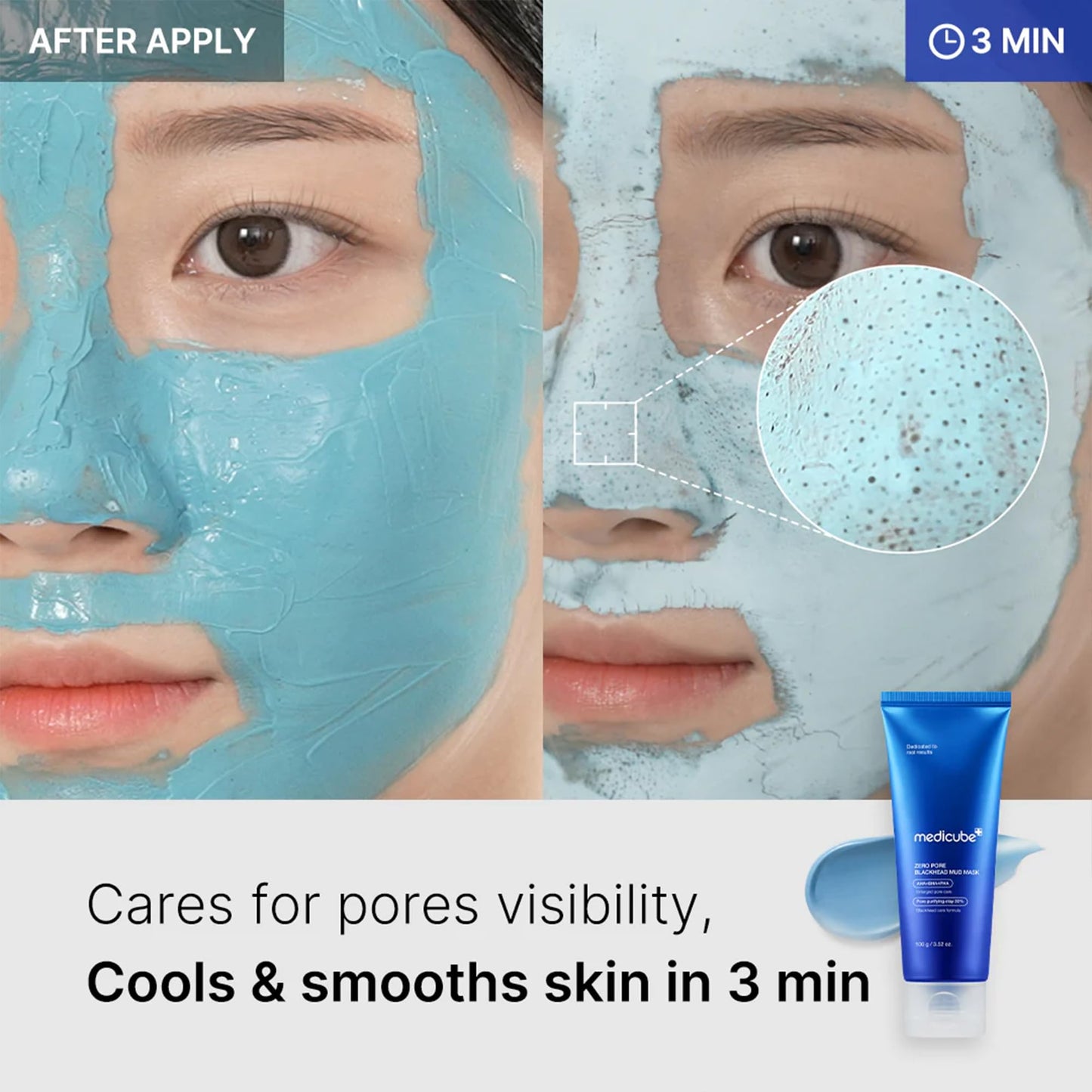 [MEDICUBE] Zero Pore Blackhead Mud Mask